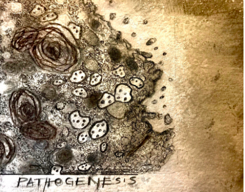 Jac Saorsa, COVID Pathogenesis. Ink and wash drawing, 2020.